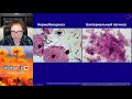 Экспертология | Аэробный вульвовагинит и бактериальный вагиноз - общее и различия