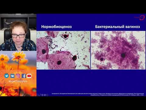 Экспертология | Аэробный вульвовагинит и бактериальный вагиноз - общее и различия