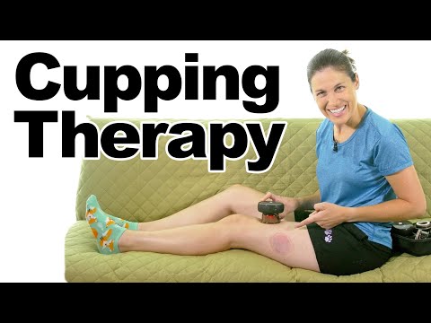 Using Cupping Therapy to Relieve Pain