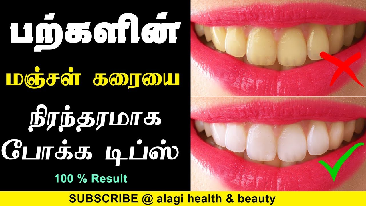 Teeth whitening tips at home in tamil