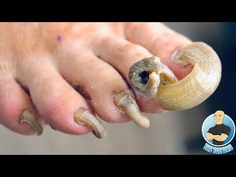 TRIMMING OF EXTREMELY THICK RAM’S HORN TOENAILS ***NOT CLICK BAIT***