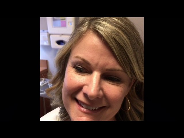 Dallas Upper Blepharoplasty/Eyelid Testimonial + Photos