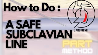 How to do a SAFE SUBCLAVIAN LINE  The PART Method