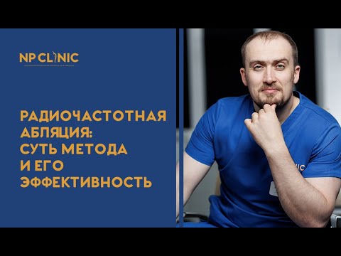 Радиочастотная абляция: суть метода и его эффективность