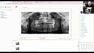 Dentistry In General Presents : Curve Hero, Cloud Based Dental Practice Management Software screenshot 3