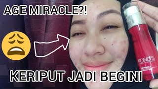 Pond's Age Miracle Youthful glow 2020 (review) bahasa Indonesia