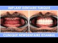 Implant dentaire en Turquie - Visite de Newdentaire à Istanbul