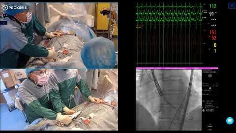 Live in a Box TAVI with the new portico FlexNav system