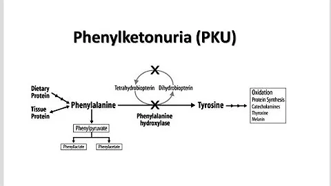Phenylketonuria as an Inborn Error of Protein Metabolism ; Causes, Symptoms, Diagnosis, Treatment