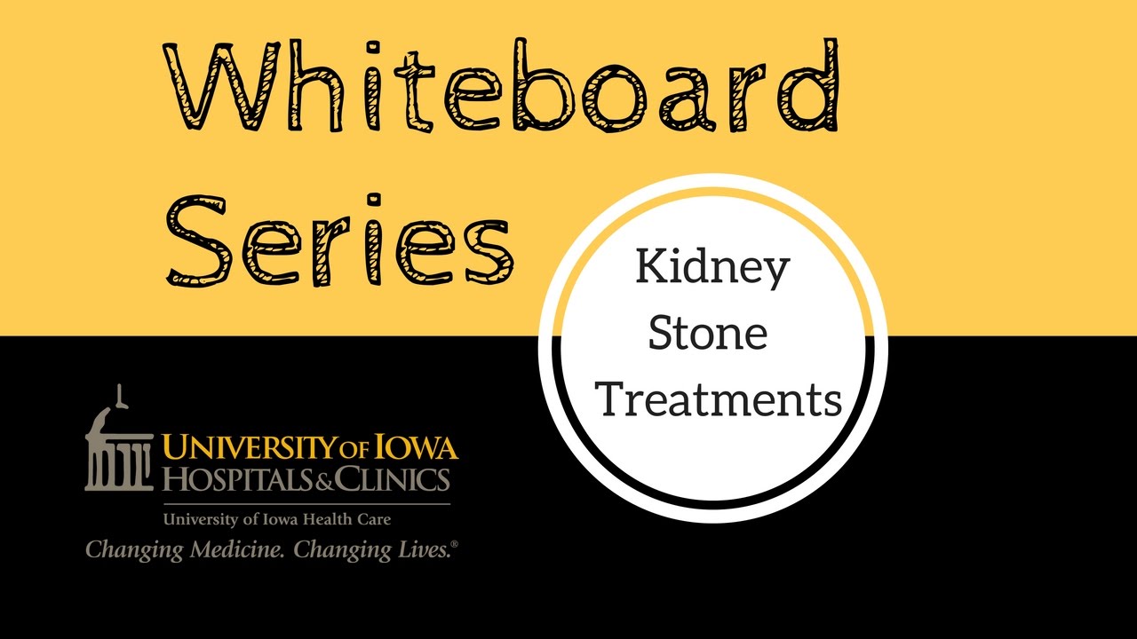 Kidney Stone Size Chart In Cm