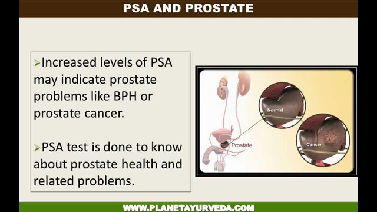How To Lower Psa Levels Quickly How to Reduce PSA levels naturally - Planet Ayurveda - YouTube
