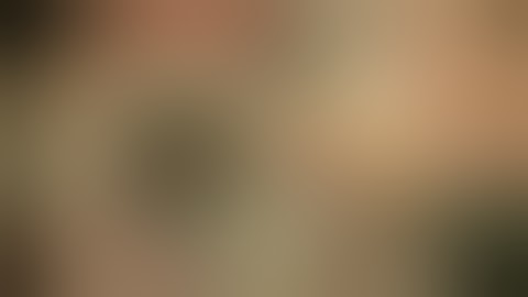 Repair of dislocated IOL via repositioning/scleral fixation by Steven G. Safran MD