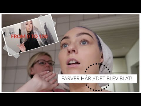 Video: Kvinde Blegede Håret Med Billigt Farvestof Og Blev Skaldet