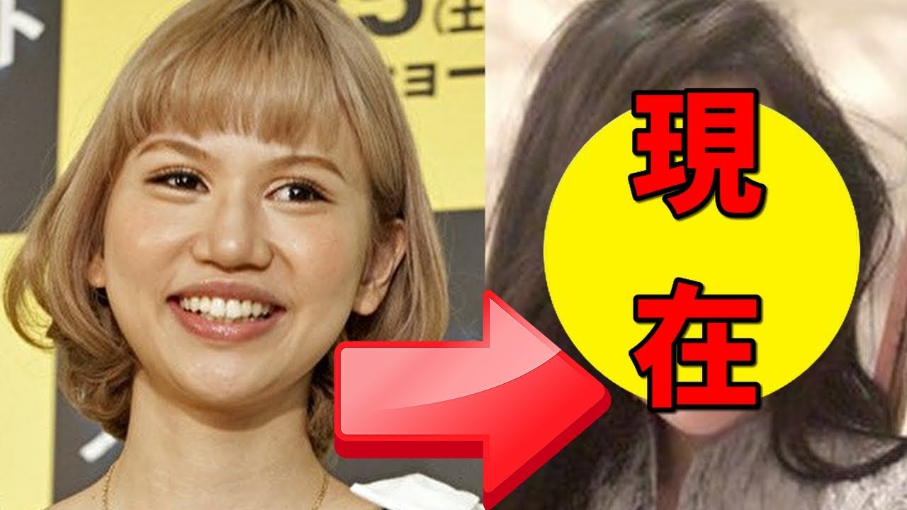 水沢アリー 30 切らないリフトアップ整形 ビフォーアフターを公開wwwwww トレンドキャッチブログ 水沢アリー 30 切らないリフトアップ整形 ビフォーアフターを公開wwwwww トレンドキャッチブログ