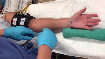 Intravenous Regional Anesthesia (Bier Block): Henry Hu, MD
