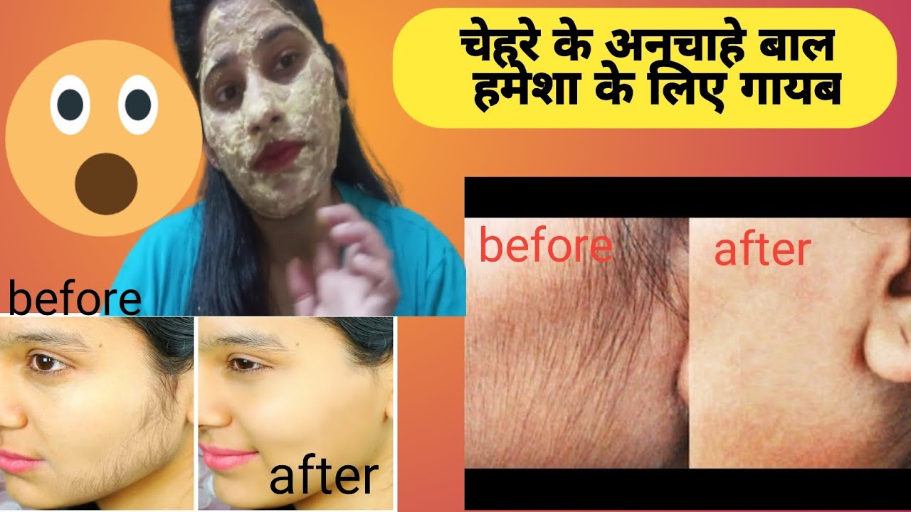 𝗵𝗼𝘄 𝘁𝗼 𝗿𝗲𝗺𝗼𝘃𝗲 𝗳𝗮𝗰𝗶𝗮𝗹 𝗵𝗮𝗶𝗿 𝗻𝗮𝘁𝘂𝗿𝗮𝗹𝗹𝘆 𝗮𝘁 𝗵𝗼𝗺𝗲 𝗰𝗵𝗲𝗵𝗿𝗲 𝗸𝗲 𝗮𝗻𝗰𝗵𝗮𝗵𝗲 𝗯𝗮𝗮𝗹