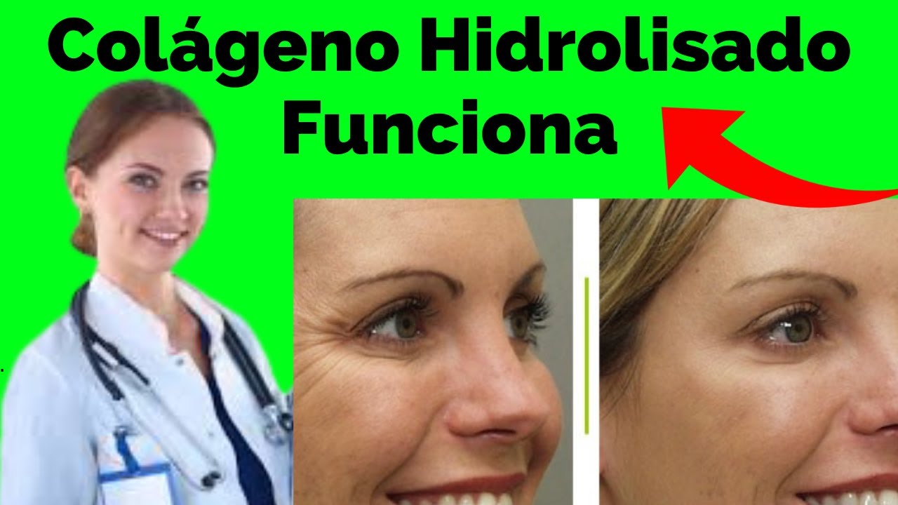 colágeno hidrolisado antes e depois, colageno, colágeno renova - YouTube