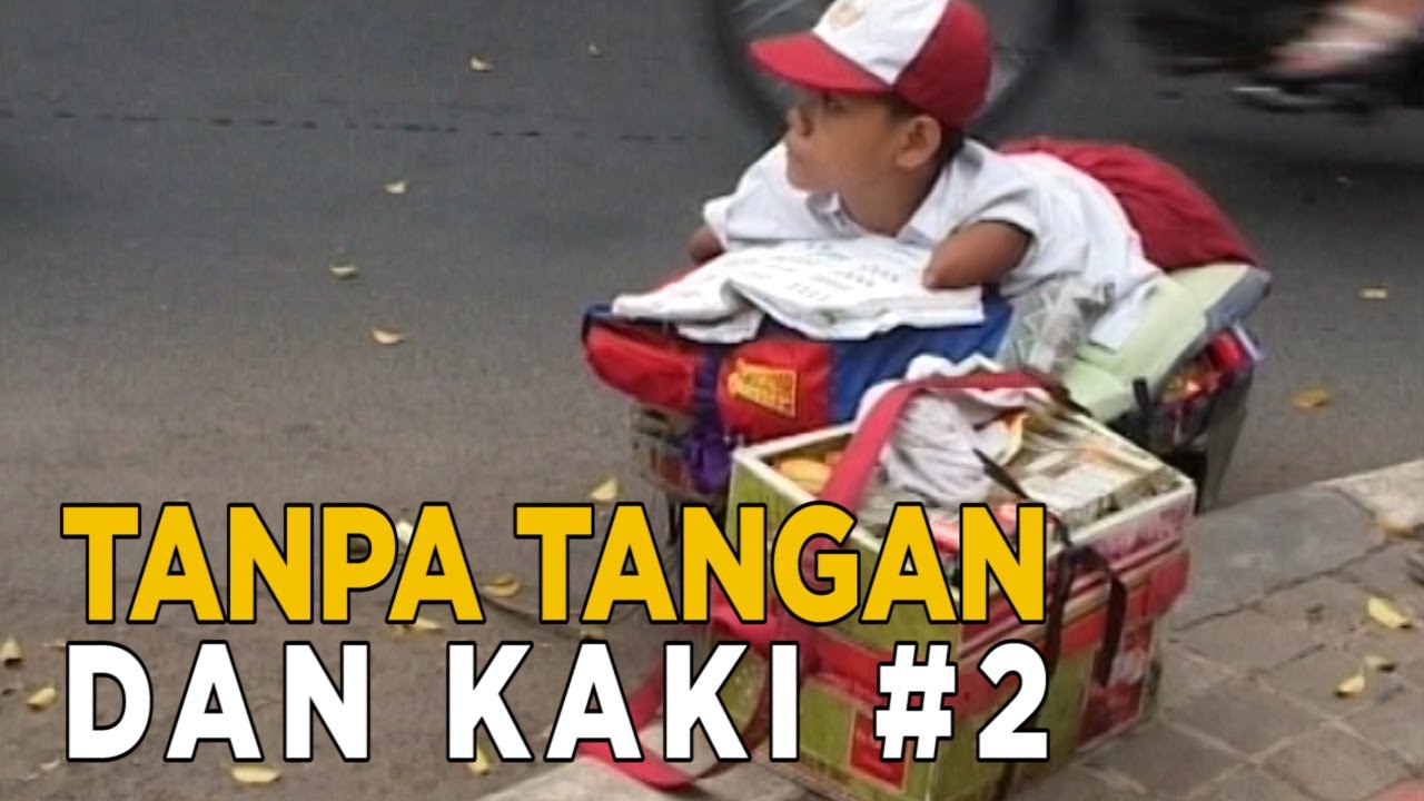 Kecacatan anakku membuatku merasa iba | KEJAMNYA DUNIA