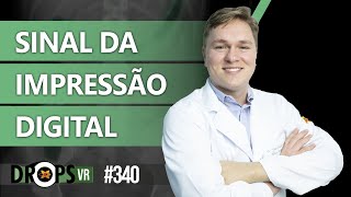 Sinal Da Impressão Digital - Identificando No Raio-X
