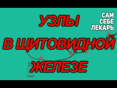 Не Будьте Злы На Узлы Щитовидной Железы Или Как Лечить Щитовидку