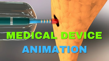 Percutaneous Blunt Dissection Animation | Advanced Medical Visualization by Austin Visuals