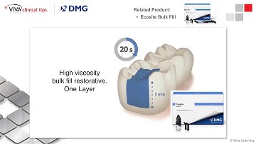 Dr.  Kleive on Ecosite Bulk Fill