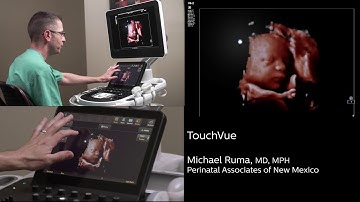 Philips TrueVue, TouchVue, MPR Touch, GlassVue, aReveal