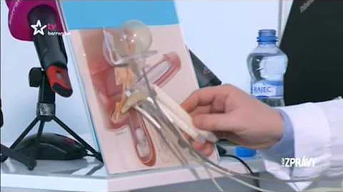 Co jsou příčiny erektilní dysfunkce?