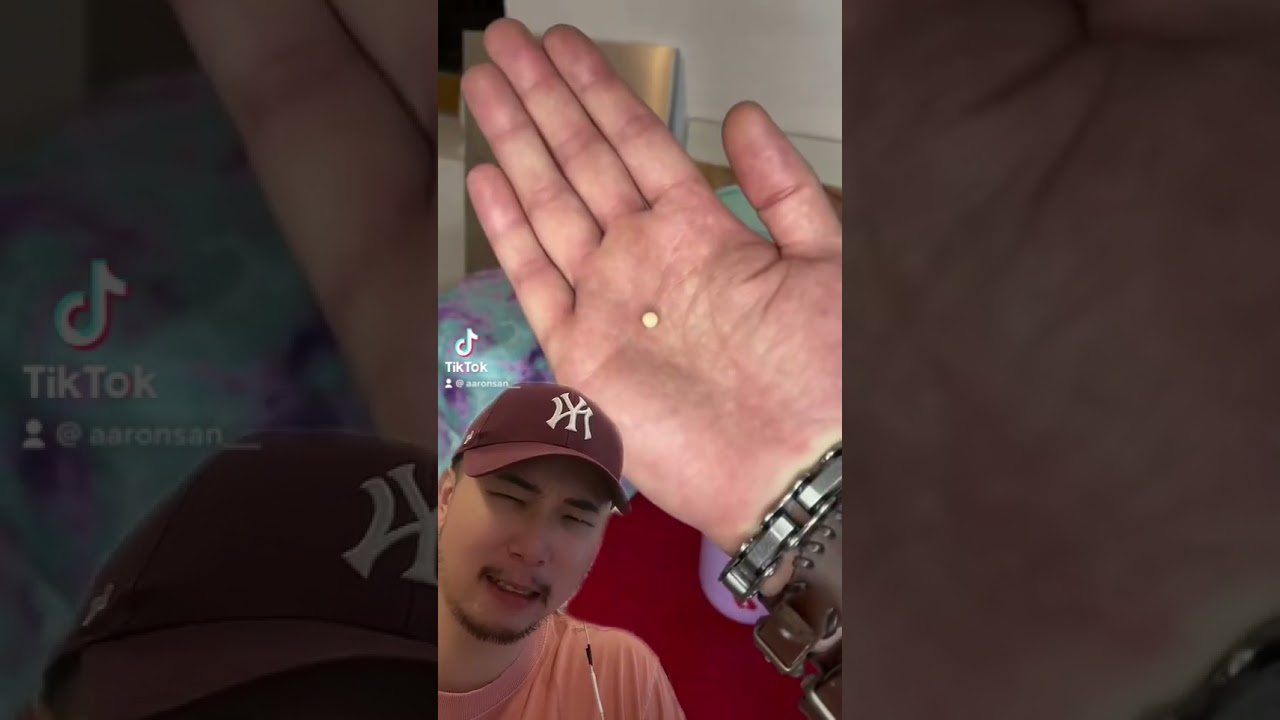 Baby bugs transformation (gross)