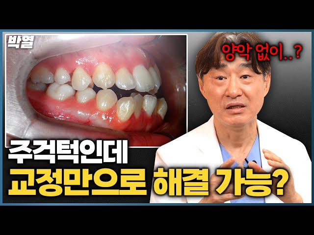 주걱턱, 교정이랑 양악 중 뭘 해야할까?