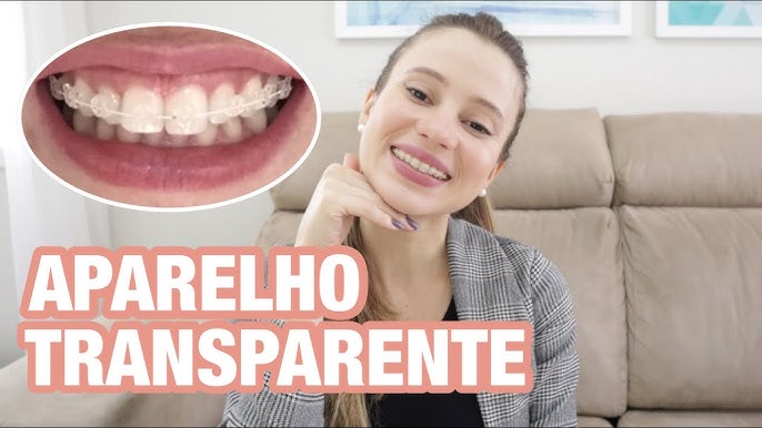 Comecei a usar aparelho transparente e esse foi o resultado » STEAL THE LOOK