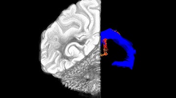 Diego García González-Rhesus monkey brain 3D reconstruction