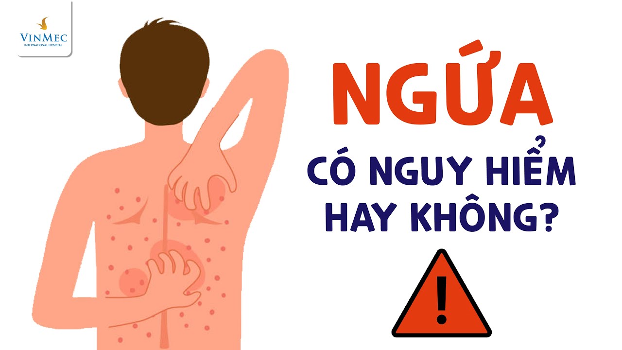 #485. Ngứa (Pruritis): dấu hiệu của nhiều bệnh nguy hiểm. Trả lời câu 2171-2190