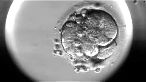 Timelapse of fertilisation of a human egg under the microscope
