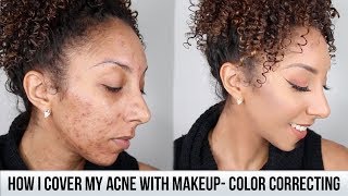 How I Cover My Acne With Makeup + Color correcting!| BiancaReneeToday