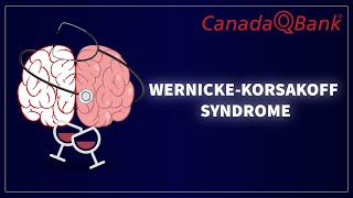 Download Lagu Syndroom van Wernicke-Korsakov: thiaminetekort, symptomen en behandeling | Neurologie vereenvoudigd MP3