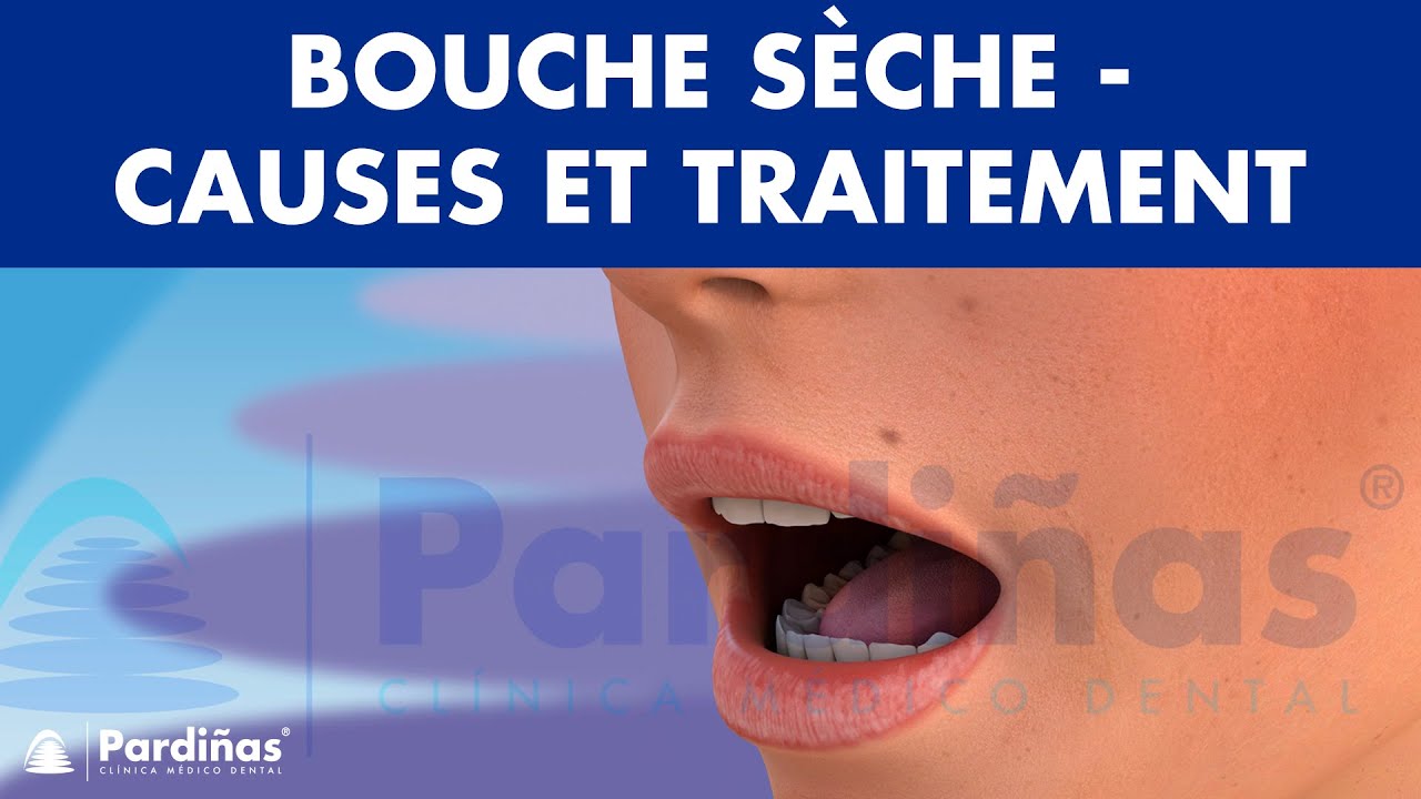 Bouche Très Sèche Au Réveil www.youtube.com