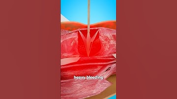 Why You Shouldn’t Remove An Arrow 😱 Surgeon Reacts