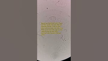 Epithelial cells in urine under the microscope #laboratory #microscope #mls #cls #medtechstudent #mt