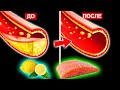 Эти продукты очистят кровь! Как очистить кровеносные сосуды   7 основных продуктов для чистки крови