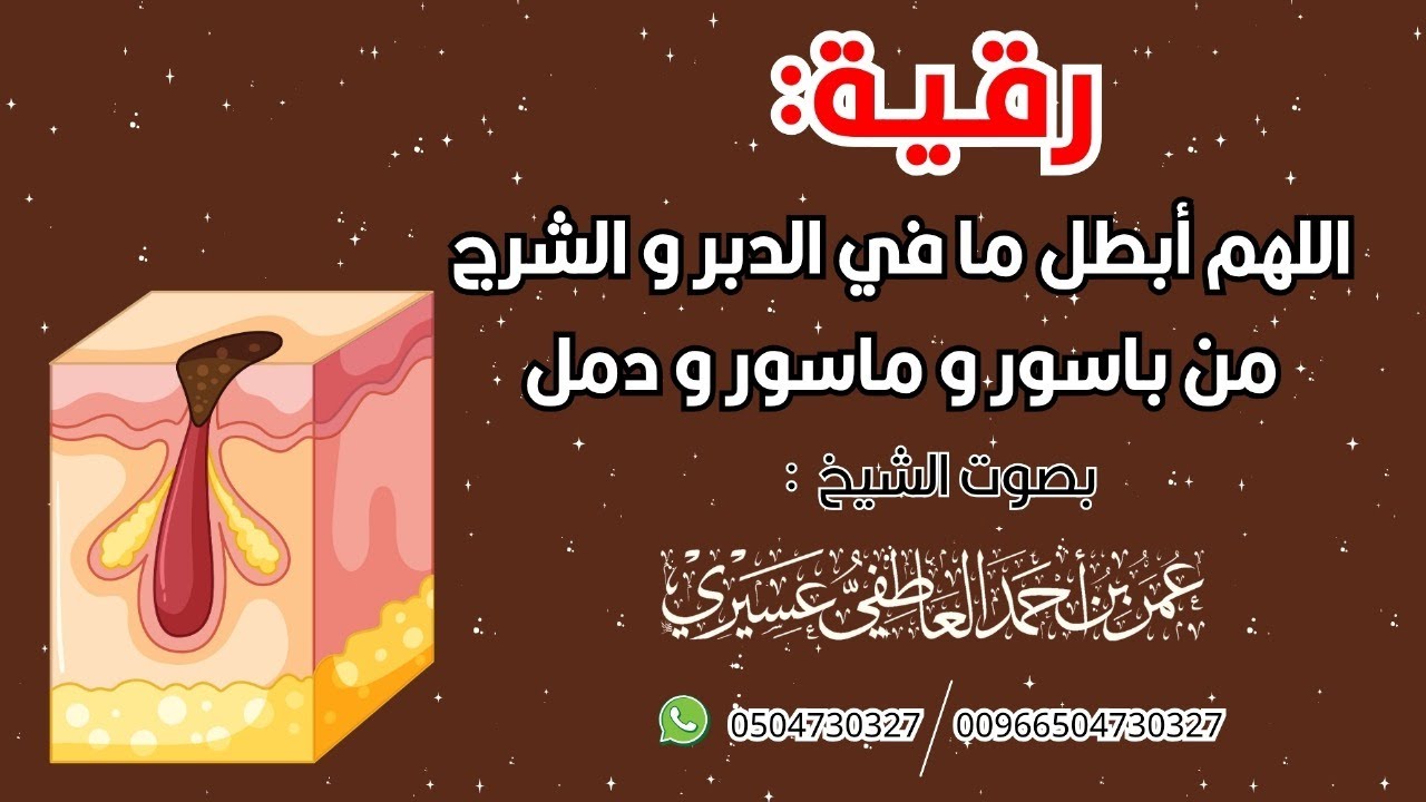 رقية: اللهم أبطل ما في الدبر و الشرج من باسور و ماسور و دمل | عمر العاطفي 