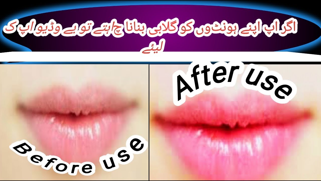 LIP CARE NATURAL RED LIPS GET RID OF DARK LIPS SMOKER LIPS HOME REMEDY HINDI YouTube