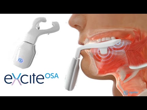 eXciteOSA - Daytime Treatment for Mild OSA and Snoring (FDA Approved Sleep Therapy Device)