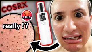 cosrx blackhead toner