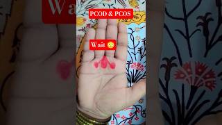 Wait😳 Accupressure points for pcod &amp; pcos #shorts #ytshorts #viralshorts #trending #feedshorts #pcod