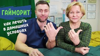 видео: Как вылечить гайморит в домашних условиях | Точки при гайморите | Александр Маркин и Татьяна Нещерет картинка: Как вылечить гайморит в домашних условиях | Точки при гайморите | Александр Маркин и Татьяна Нещерет