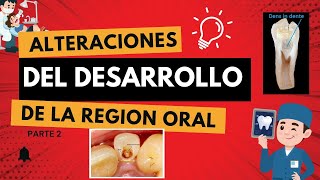 Alteraciones Del Desarrollo De La Región Oral Parte2 Patología Oral Y Maxilofacial