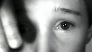 Dissociated Vertical Divergence [ARCHIVE]