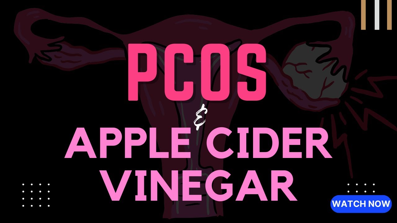 Polycystic Ovarian Syndrome (PCOS) and Apple Cider Vinegar Apple