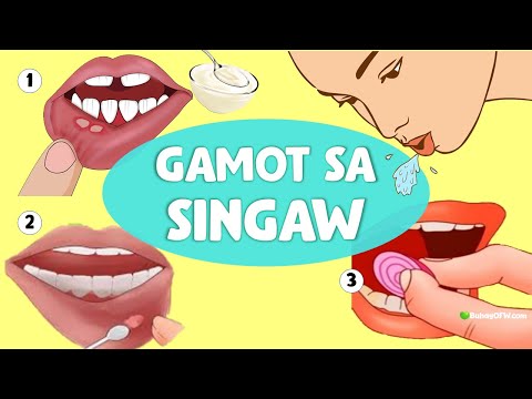 Video: 13 Mga Paraan sa Paggamot at Pag-iwas sa Mga Tuyo o Basag na labi